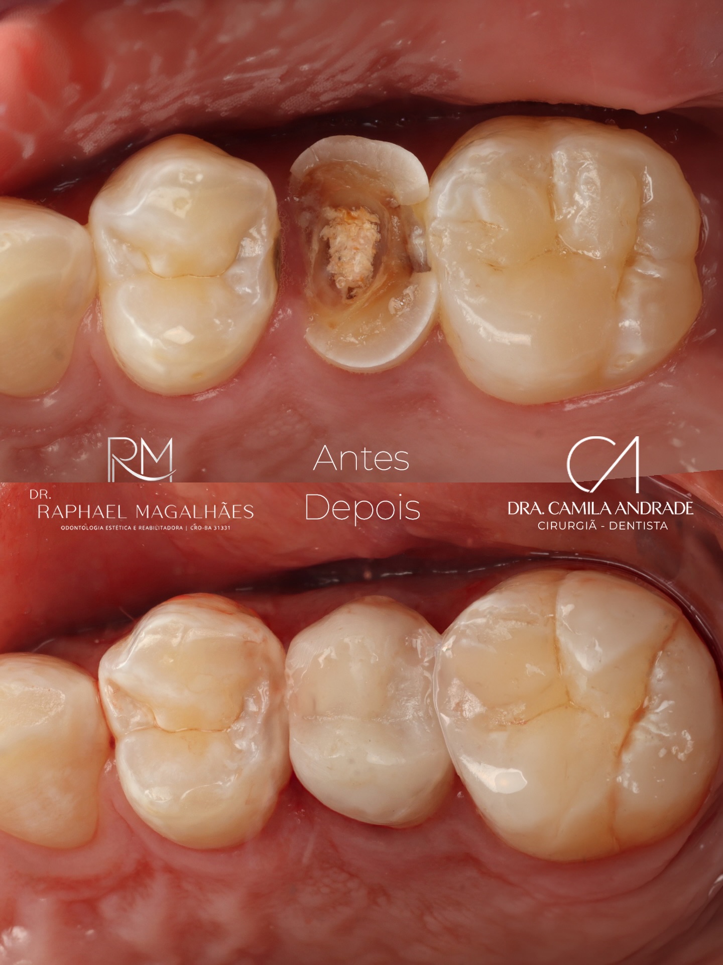 Restauração estética